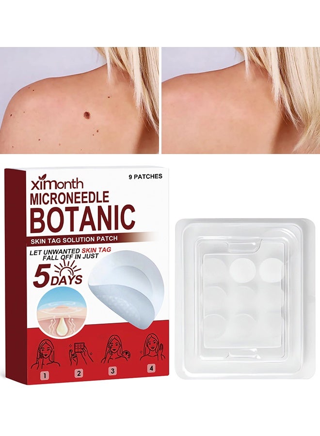 ximonth Microneedle Botanic Skin Tag Solution Patch, 9 Pcs Skin Tag Remover Patches,  Acne Blemish Remover, Balances Oil And Moisture, Safe & Gentle, Waterproof Adhesive, Natural Plant, Based Ingredients For Small To Medium Skin Tags On Face & Body - Image 1